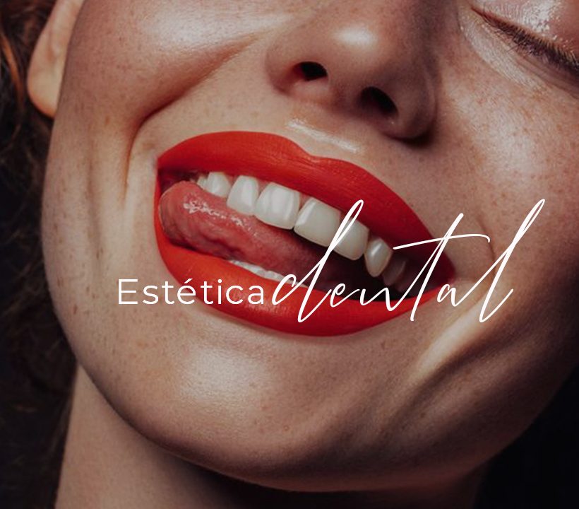 esteticadental1